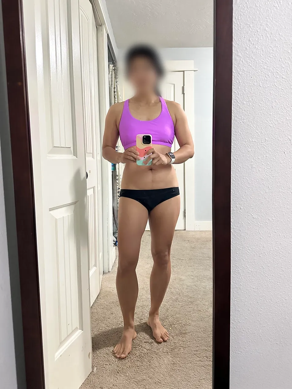 Patient weight-loss progress — After