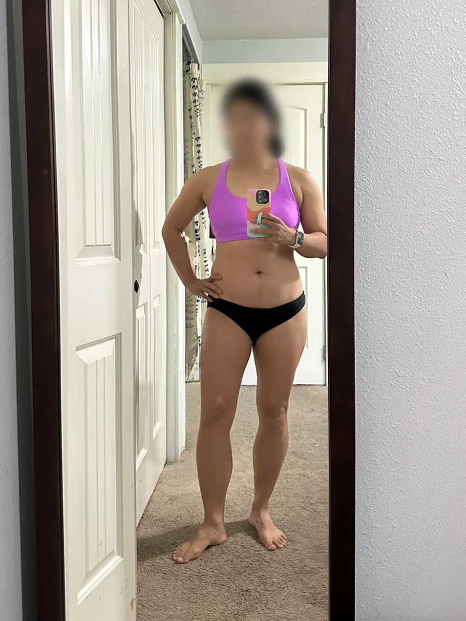 Patient weight-loss progress — Before