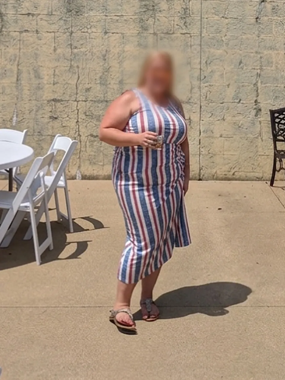 Patient weight-loss progress — Before